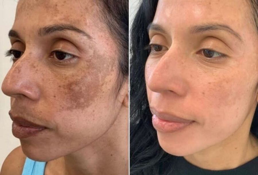 Before / After